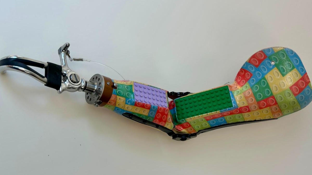 Custom LEGO prosthetic expands play possibilities